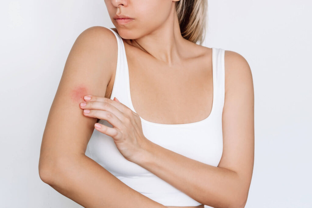 Woman inspects psoriasis spot on her right arm